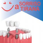 Sorriso a tirana